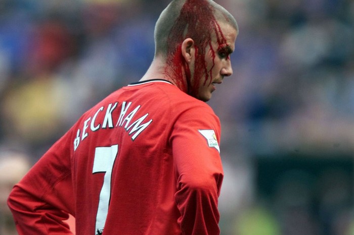 David Beckham, Manchester United (2000)